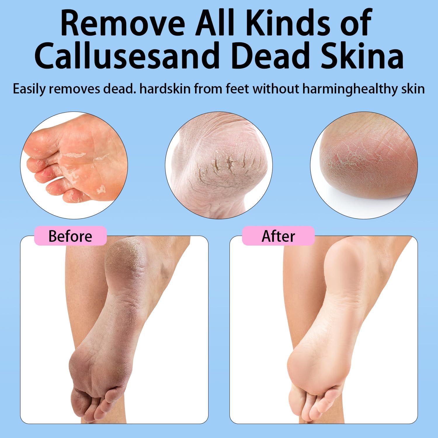 Electric Foot Callus Removers Rechargeable - Electric Foot File with 9 Adjustable Speed, 2 Grinding Heads & 30 Pcs Sandpaper Discs,Professional Foot Sander for Feet Dead Skin and Calluse (Pink)