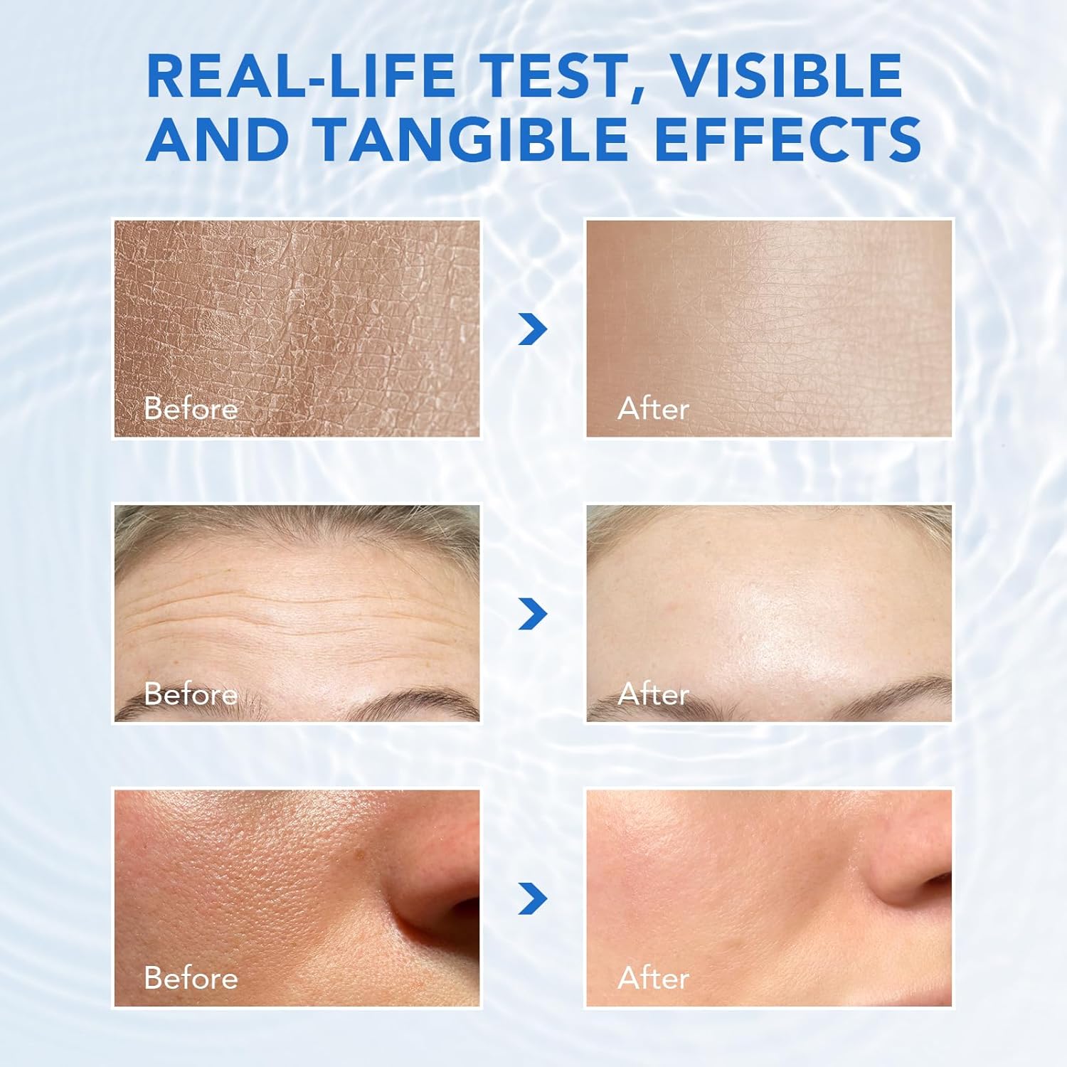 3% Hyaluronic Acid Serum for Face Ultra-Hydrating Vials Skin Care Tightes Skin, Non-greasy Formula, Absorbs Quickly, 30PCS 36ml